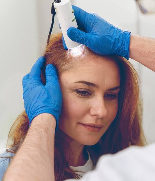 Avaliação de alopecia androgenética na linha frontal